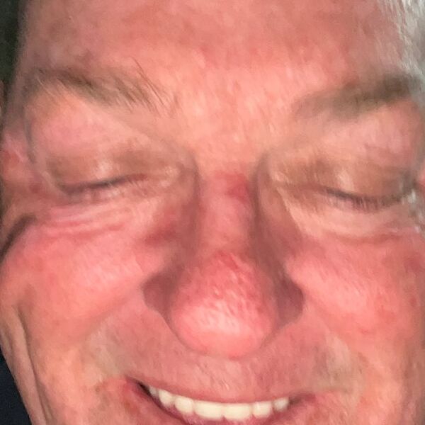 MICK